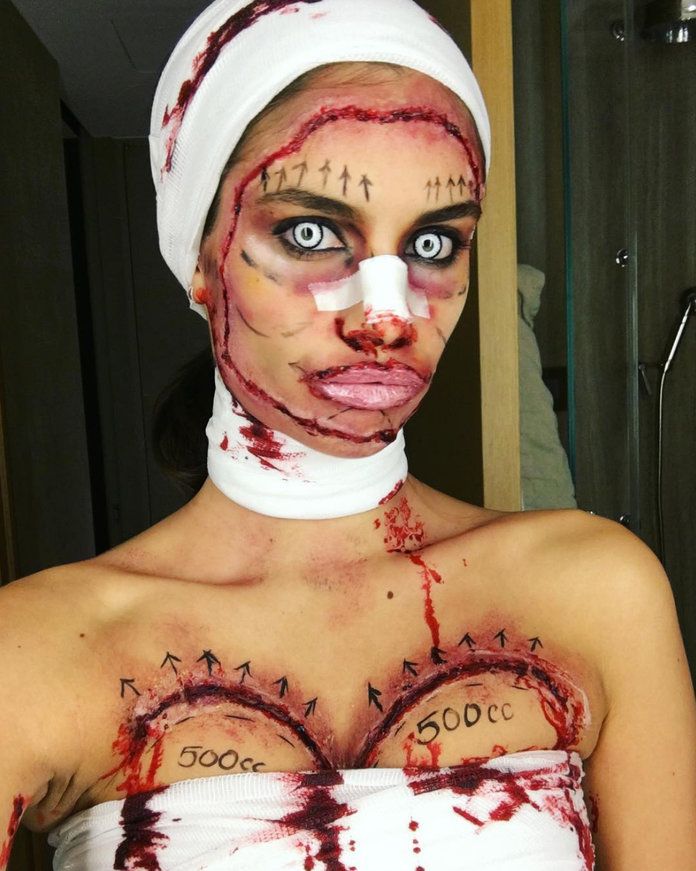 שרה Sampaio as a victim of bad plastic surgery 