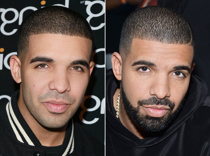 זקן or No Beard - Drake